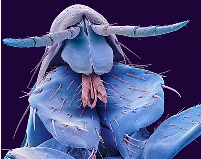 Pulex irritans